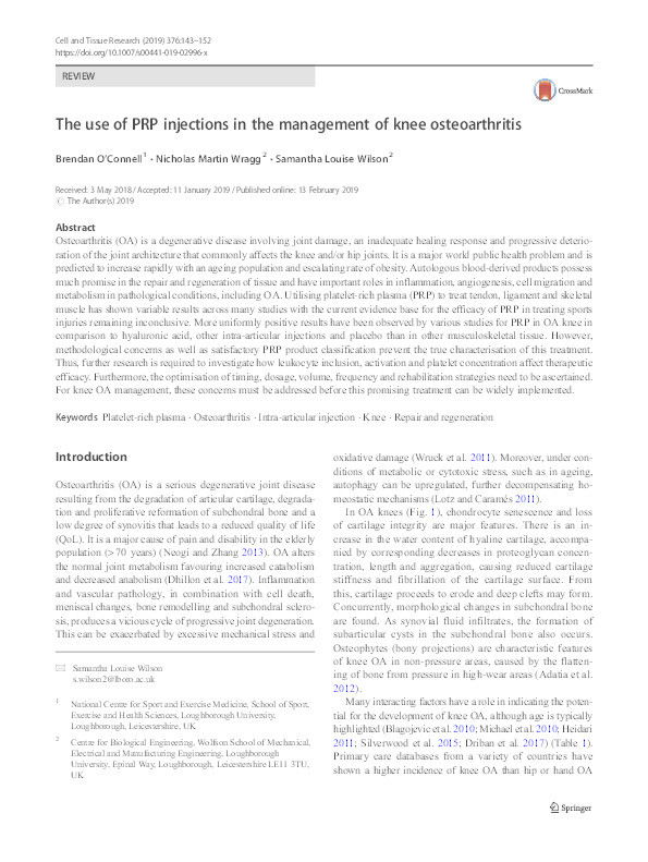 The use of PRP injections in the management of knee osteoarthritis. Thumbnail