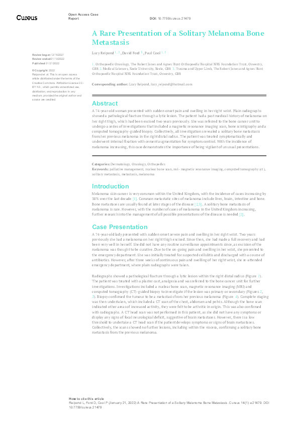 A Rare Presentation of a Solitary Melanoma Bone Metastasis. Thumbnail